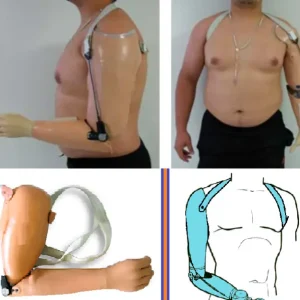 Prótesis para desarticulado de codo